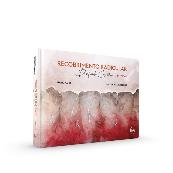 Recobrimento Radicular – Desafiando Conceitos